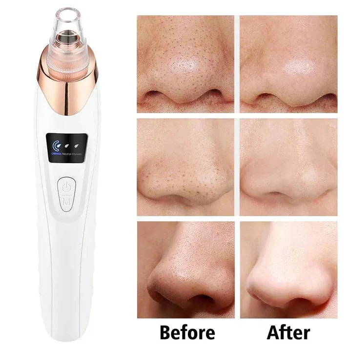 5 in 1 Black Head Remover machine Pimple Pore Cleaner Vacuum Suction Tool