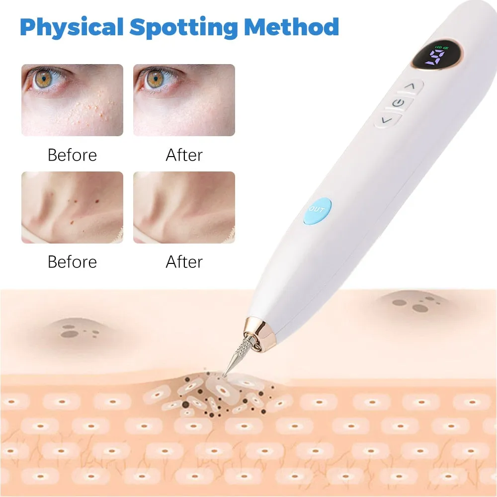 9 Mode Plasma Pen Freckle Remove Pen Wart Remover Mole Tattoo Remover Instruments Skin Tag Removal Spot Cleaner Beauty Care Tool