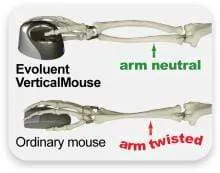 Evoluent Vertical Mouse 4