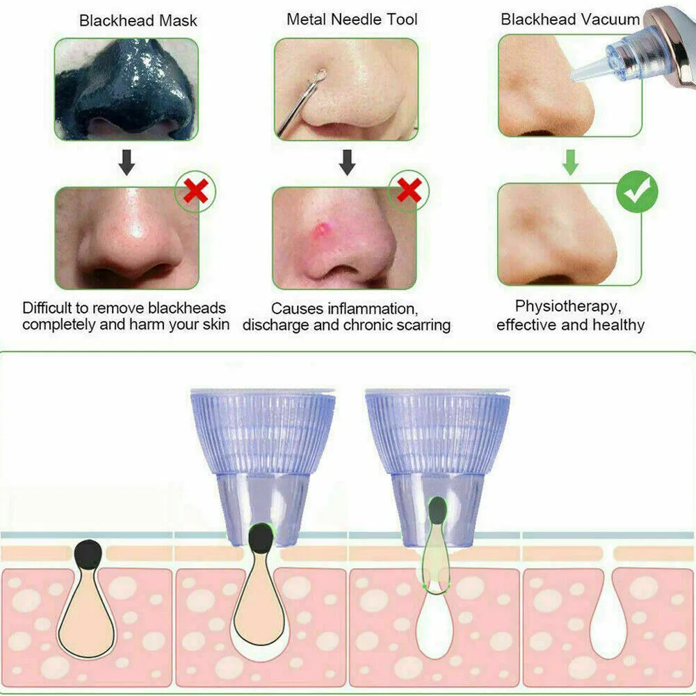 US 2-4 Pack Electric Blackhead Comedone Remover Pore Vacuum Cleaner RECHARGEABLE