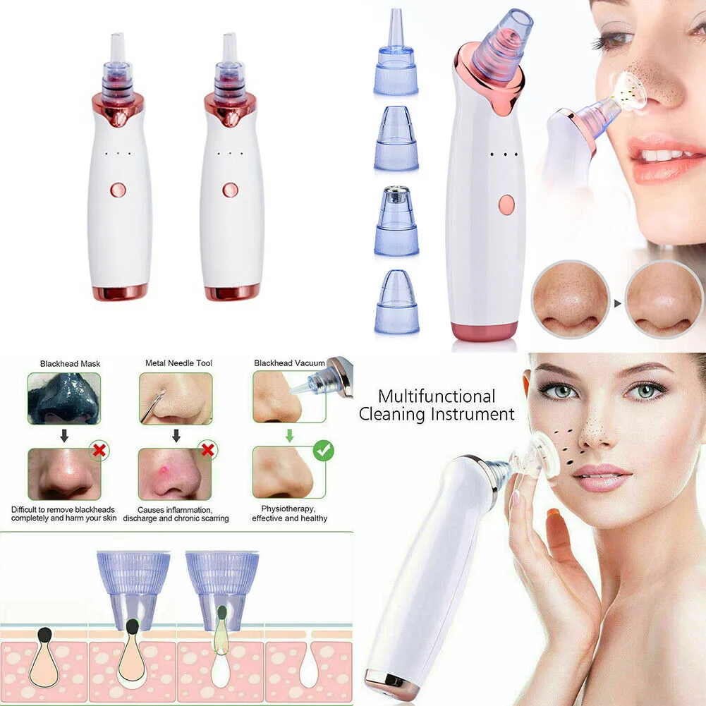 US 2-4 Pack Electric Blackhead Comedone Remover Pore Vacuum Cleaner RECHARGEABLE