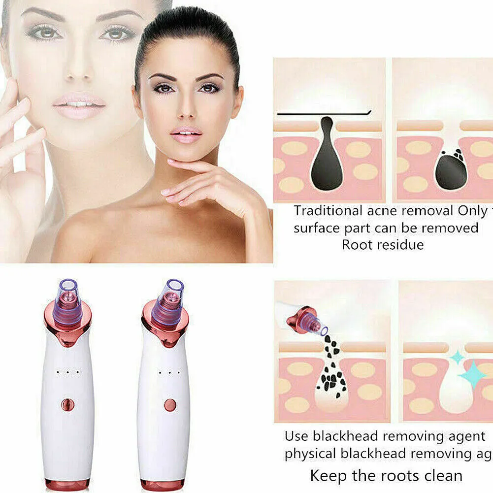 US 2-4 Pack Electric Blackhead Comedone Remover Pore Vacuum Cleaner RECHARGEABLE